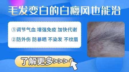 白斑处毛发变白是不是白癜风