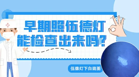 伍德灯下瓷白色一定是白癜风吗