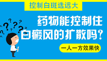 吃什么药能控制白斑不发展