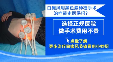 黑色素种植治白癜风效果好不好