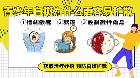 青少年得了白癜风用哪种药治