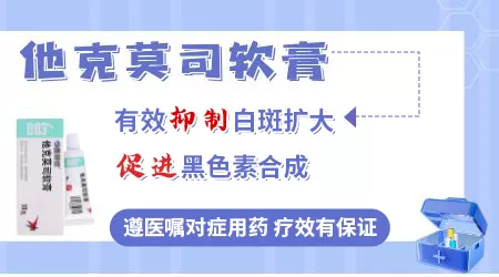 他克莫司软膏能治疗白癜风吗