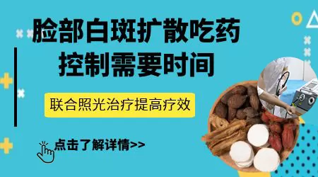 脸上长的白癜风发展了该怎么办