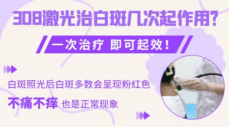 白癜风照光几次恢复正常