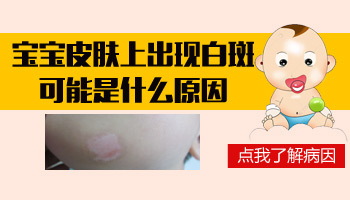 宝宝肚子上发现了一块白斑