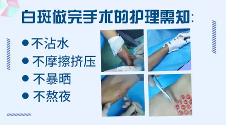 黑色素种植治疗白癜风哪家医院好