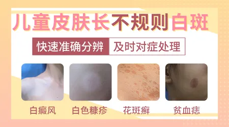 儿童腿上皮肤变白一块是怎么回事