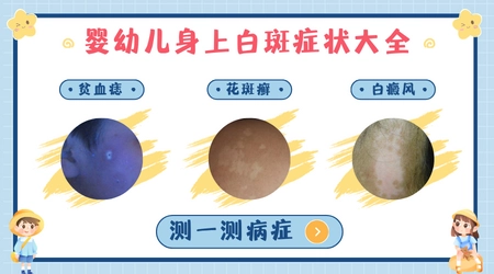 婴儿身上出现白斑是什么原因