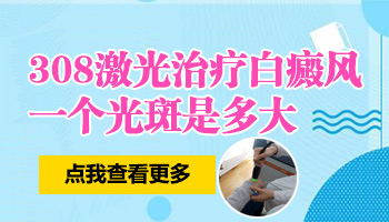 308激光照白癜风一个光斑有多大面积