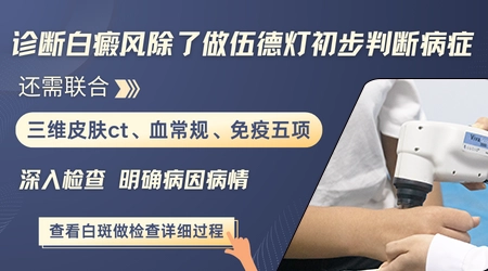 伍德灯检查会不会误诊