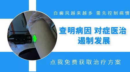 青少年脸上白癜风越来越多如何控制