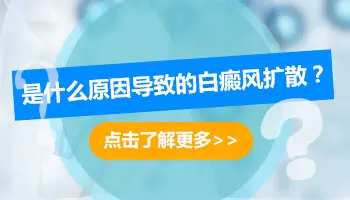 白癜风不治疗会扩散吗 病情加重有哪些表现