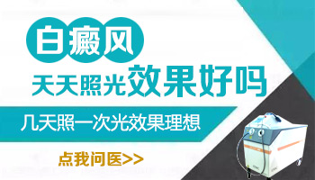 308激光治疗白癜风可以天天照吗