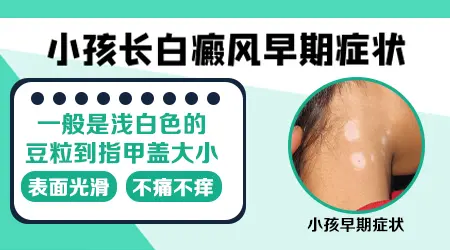 儿童白斑病早期症状图