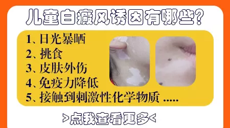 小孩子白癜风症状图片