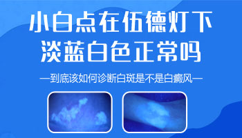 伍德灯下淡蓝色的白斑是什么