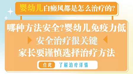 婴幼儿白癜风的治疗方法