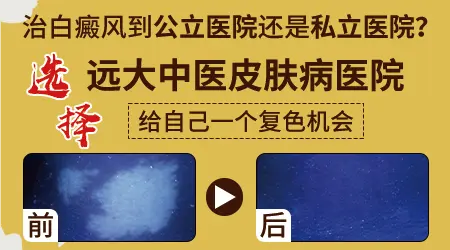 白斑和白癜风的区别图