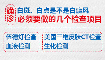 身上长白点需要做什么检查看是不是白癜风