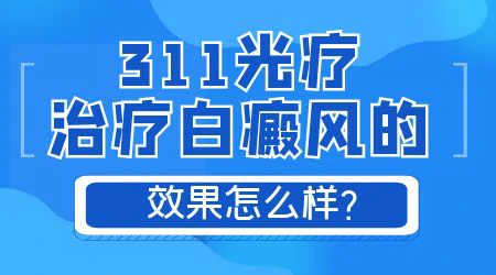 光疗治白斑效果好不好
