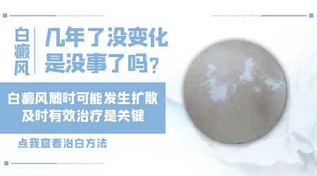 胸下有一块白斑三年了没变化用治疗吗