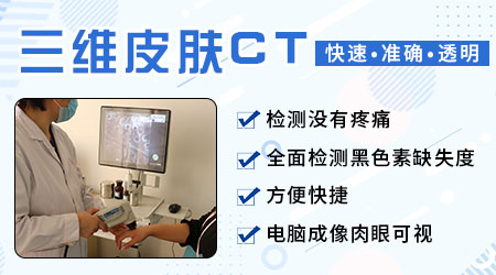 [公布]美国三维皮肤CT检测白斑多少钱