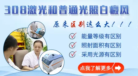 照完308白癜风患者多久能洗澡