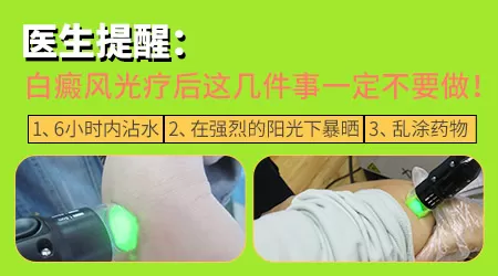 311光疗照光治疗白癜风中间间隔多久