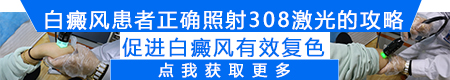 308激光照白斑恢复过程是怎样的