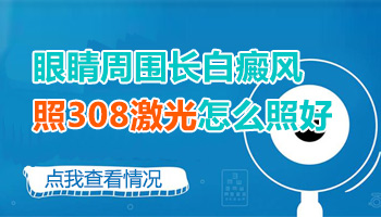 眼皮上有白癜风能照308激光治疗吗