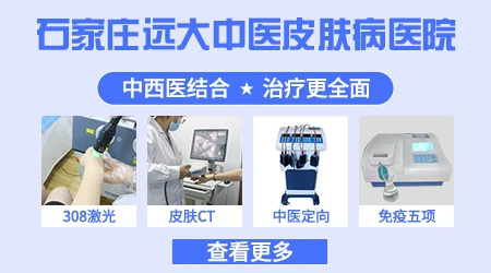 青少年白癜风一般采取什么办法治疗管用