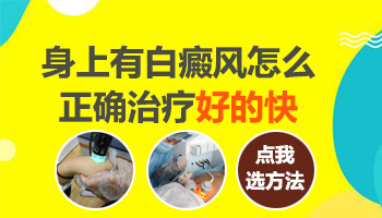 白斑长在屁股上和大腿根部怎么治疗好