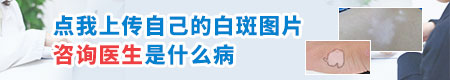 产后肚子长白斑是怎么回事