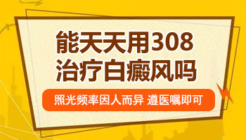 用308治疗白癜风需要天天照射吗