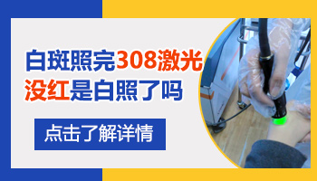 308激光照白癜风白斑没发红是不是没效果