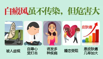 白癜风不治对人有哪些危害