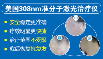 白癜风无针介入多少钱