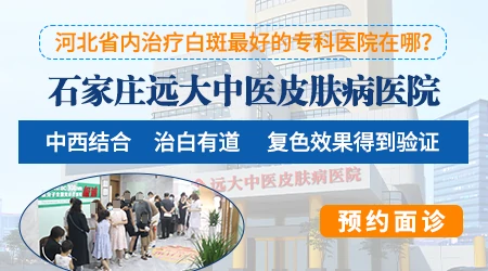 石家庄哪里能治好白癜风