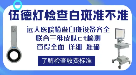 wood灯检查白斑很准吗 白斑是白癜风几率有多大