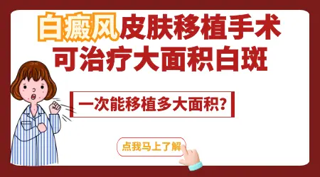 白癜风能做手术种植吗 种植白癜风对比图