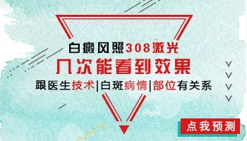 手指白癜风做完308激光能碰水吗