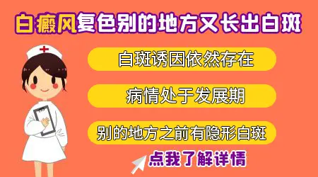 白癜风复色后周边会继续白吗