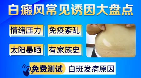 怎么判断是白癜风