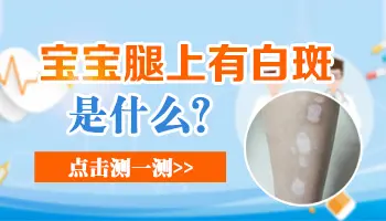 小孩腿部大面积白斑图片