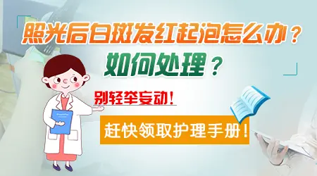 308激光照白斑剂量照大了怎么处理