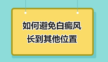 白癜风一般都长在什么位置 做什么检查