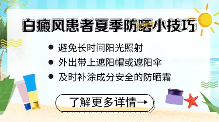 夏季白癜风扩散怎么治能好