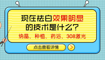 治疗白癜风去三甲好还是专科医院就好