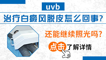 uvb308照了白癜风之后有什么反应