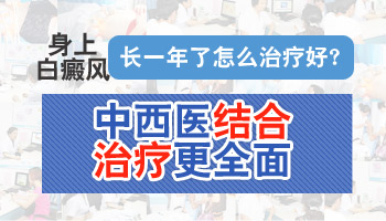 白癜风有一年多了用什么方法治